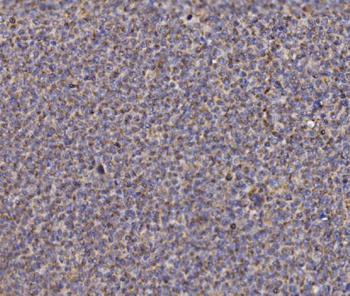 Anti-NDUFAF1 Antibody