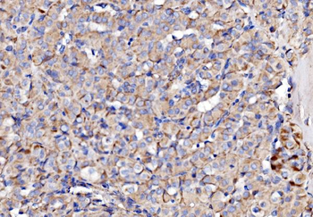 Anti-NDUFAF1 Antibody