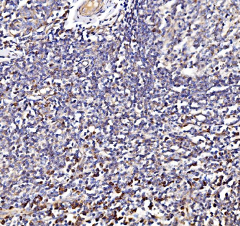 Anti-NDUFAF1 Antibody