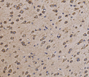Anti-NDUFAF1 Antibody