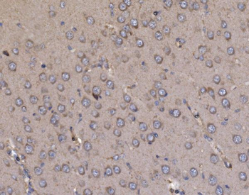 Anti-NDUFAF1 Antibody