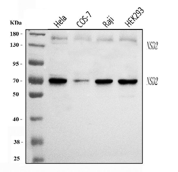 WHSC1/NSD2 Rabbit Polyclonal Antibody