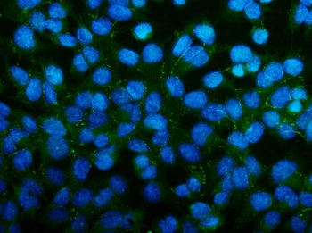 Anti-PAR-3/PARD3 Antibody