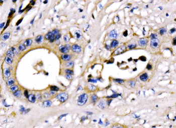 Anti-PAR-3/PARD3 Antibody
