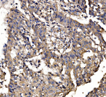 Anti-PAR-3/PARD3 Antibody