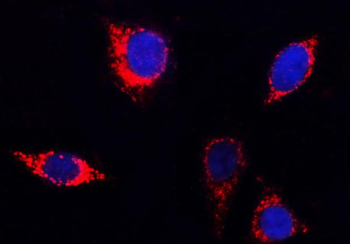 Anti-PITRM1 Antibody