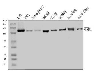 Anti-PITRM1 Antibody