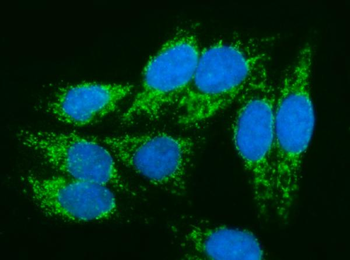 Anti-PMPCA/INPP5 Antibody
