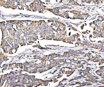 Anti-PMPCA/INPP5 Antibody