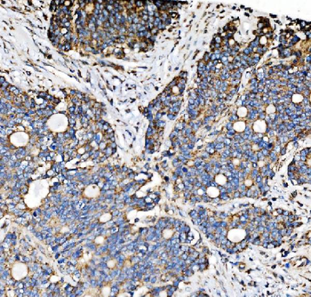 Anti-PMPCA/INPP5 Antibody