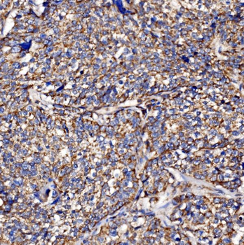 Anti-PMPCA/INPP5 Antibody
