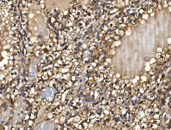 Anti-PMPCA/INPP5 Antibody