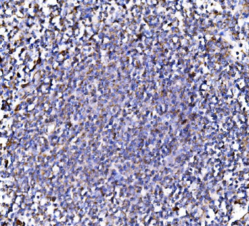 Anti-PMPCA/INPP5 Antibody