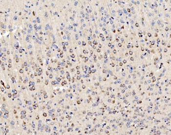 PMPCA/INPP5 Antibody