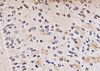 Anti-PMPCA/INPP5 Antibody