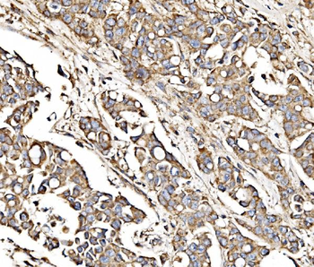 Anti-MPPB/PMPCB Antibody