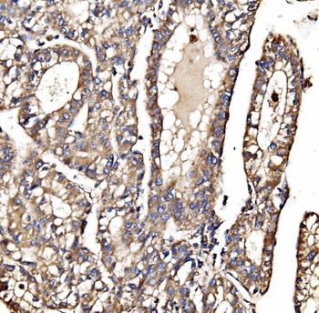 Anti-MPPB/PMPCB Antibody