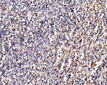 Anti-MPPB/PMPCB Antibody