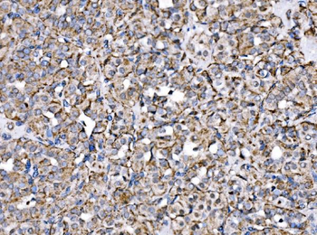 Anti-MPPB/PMPCB Antibody
