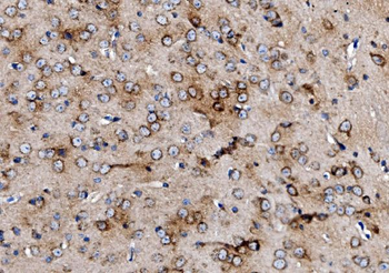 Anti-MPPB/PMPCB Antibody