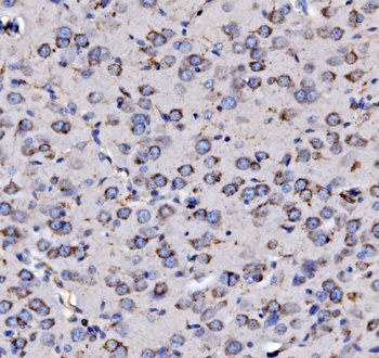 Anti-MPPB/PMPCB Antibody