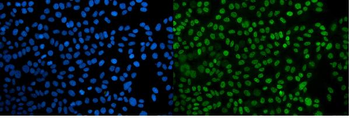 Anti-PPIL3 Antibody