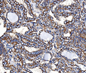 Anti-Paxillin/PXN Antibody