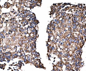 Anti-Paxillin/PXN Antibody