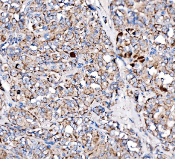 Anti-Paxillin/PXN Antibody