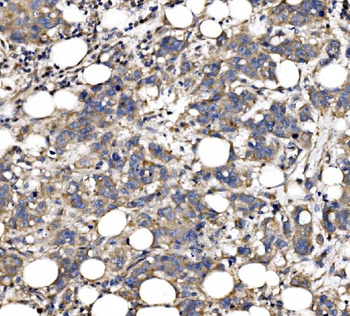 Anti-QSOX2 Antibody