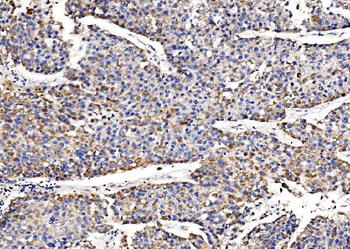 Anti-QSOX2 Antibody
