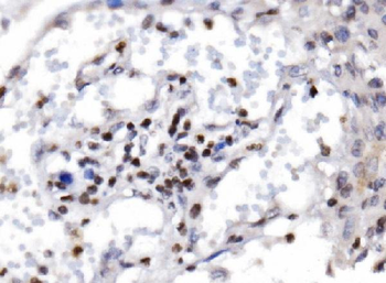 Anti-RAX2 Antibody