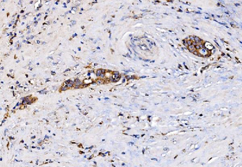 Anti-MIRO1/RHOT1 Antibody