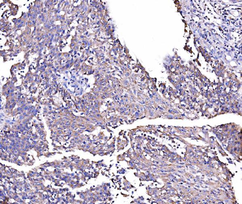 Anti-MIRO1/RHOT1 Antibody
