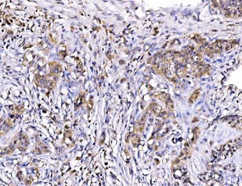 Anti-MIRO1/RHOT1 Antibody