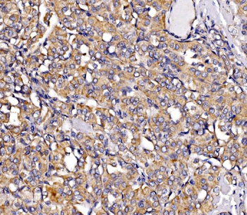 Anti-MIRO1/RHOT1 Antibody