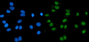 Anti-RNF20 Antibody