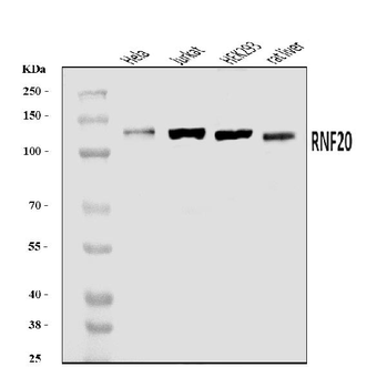 Anti-RNF20 Antibody