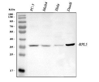 Anti-RPL5 Antibody