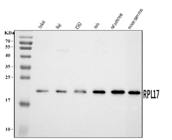Anti-RPL17 Antibody