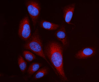 Anti-RPL17 Antibody