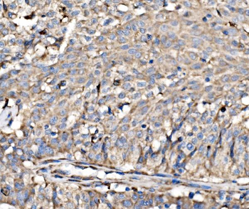 Anti-RPL17 Antibody