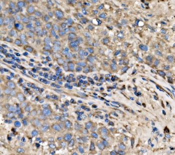 Anti-RPL17 Antibody