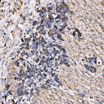 Anti-RPL17 Antibody