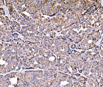 Anti-RPL17 Antibody