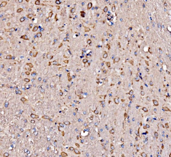 Anti-RPL17 Antibody