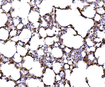 Anti-RPL17 Antibody