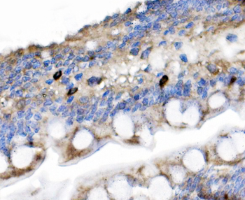 Anti-Secretin/Sct Antibody