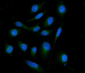 Anti-SH3GL2 Antibody
