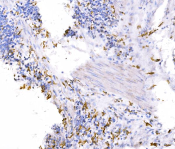Anti-SH3GL2 Antibody